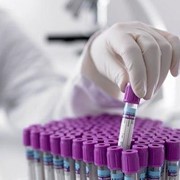 Коагулограмма фото