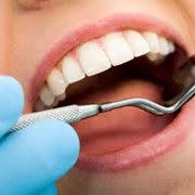 Терапевтическая стоматология,Пломба из фотополимерного материала