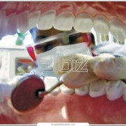 Хирургическая стоматология фотография