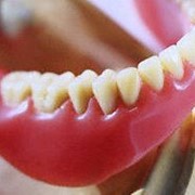 Съемное протезирование (зубные протезы) фотография