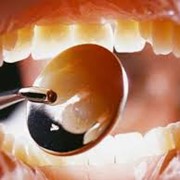 Синус лифтинг, имплантация зубов фотография