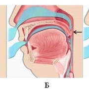 Заболевания ЛОР-органов и дыхательной системы