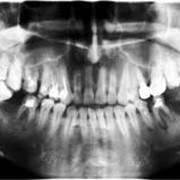 Рентгенология и лечение зубов на Осокорках фото