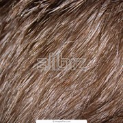 Пересадка волос фото
