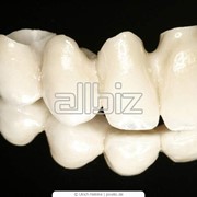 Протезирование зубов съемное фотография