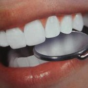 Отбеливание зубов фото