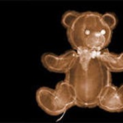 Рентгенография фото