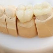 Ортодонтическое лечение