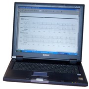 Система амбулаторного мониторирования состояния сердца ЭЛСКАН фото