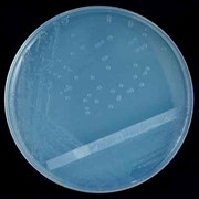 Питательная среда для культивирования и выделения чумного микроба сухая (ЧПС селективная) фотография